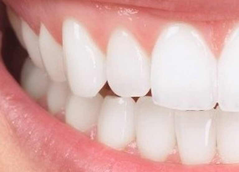 se-refaire-les-dents-en-hongrie