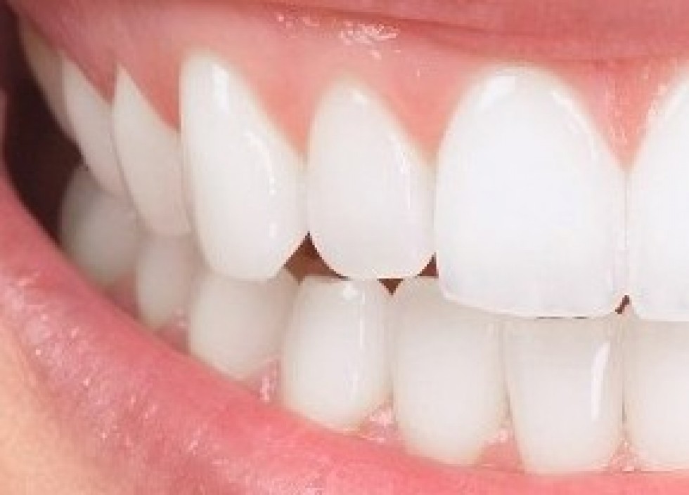 se-refaire-les-dents-en-hongrie