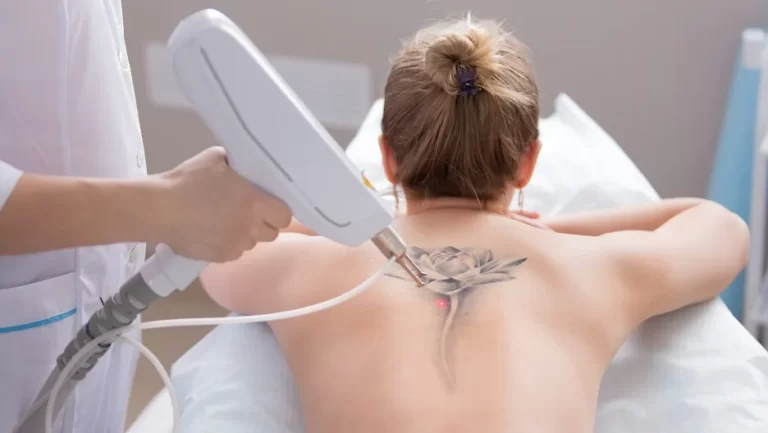 tatouages