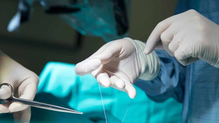 chirurgie-membre-superieur-paris-operation-main-suturee