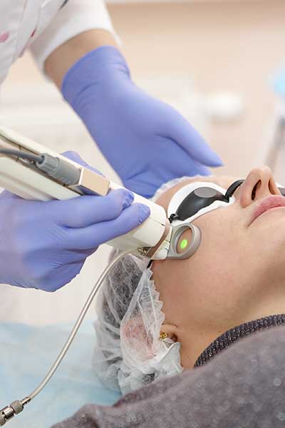 laser-esthetique-visage