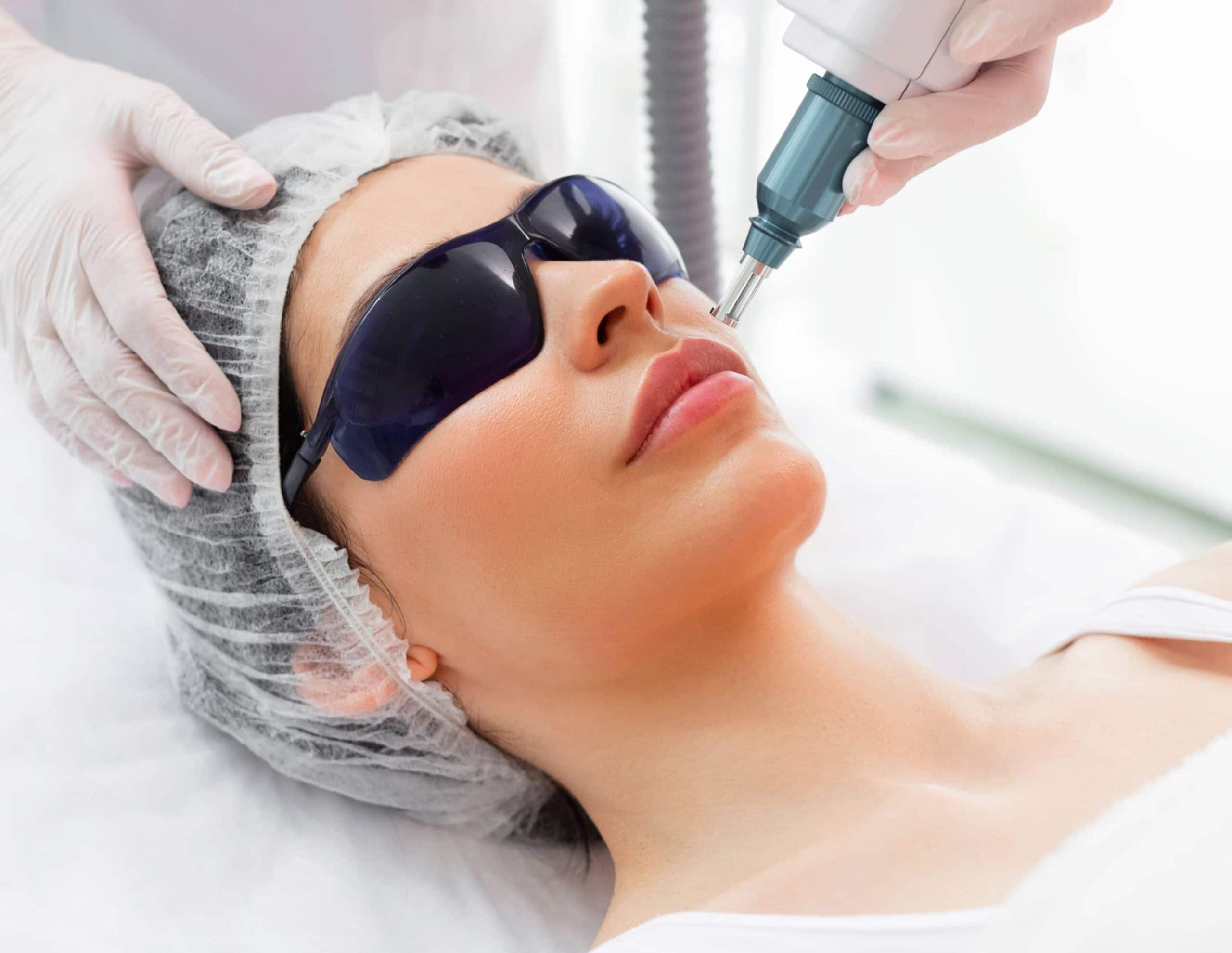 peeling-laser-dr-gerard-rivalier-lyon-scaled