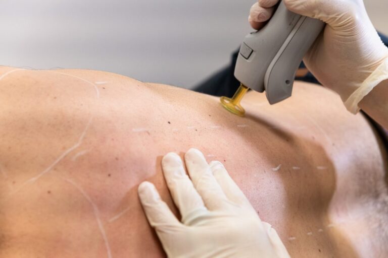 Epilation-laser-dos-Dermo-Laser-Lyon-1024x683