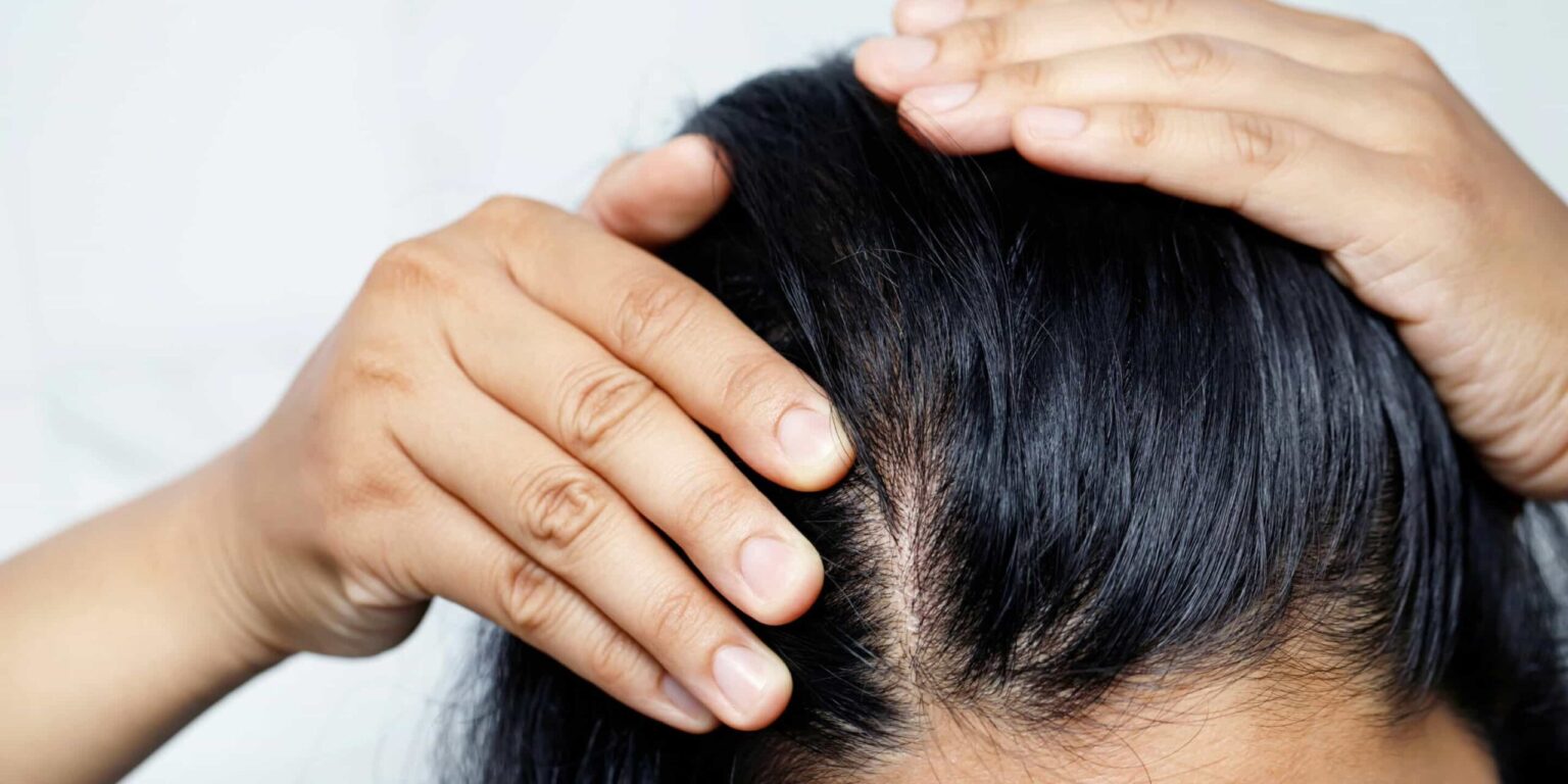 Nos cheveux en disent long sur notre état de santé général. Bien plus qu'un simple accessoire esthétique, ils peuvent révéler des déséquilibres nutritionnels, hormonaux ou même des pathologies sous-jacentes. Voici 10 signes capillaires à surveiller pour un diagnostic précoce et une prise en charge adaptée.