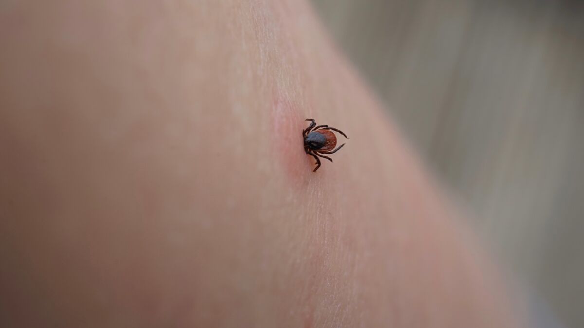 maladie-de-lyme-les-symptomes-a-surveiller-apres-une-morsure-de-tiques