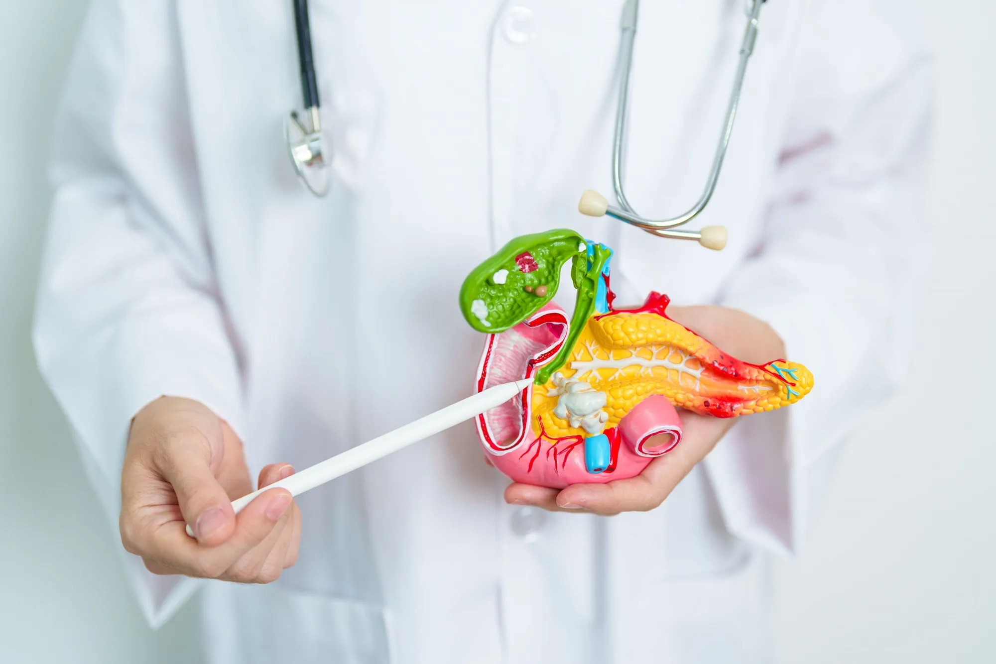cancer pancreas