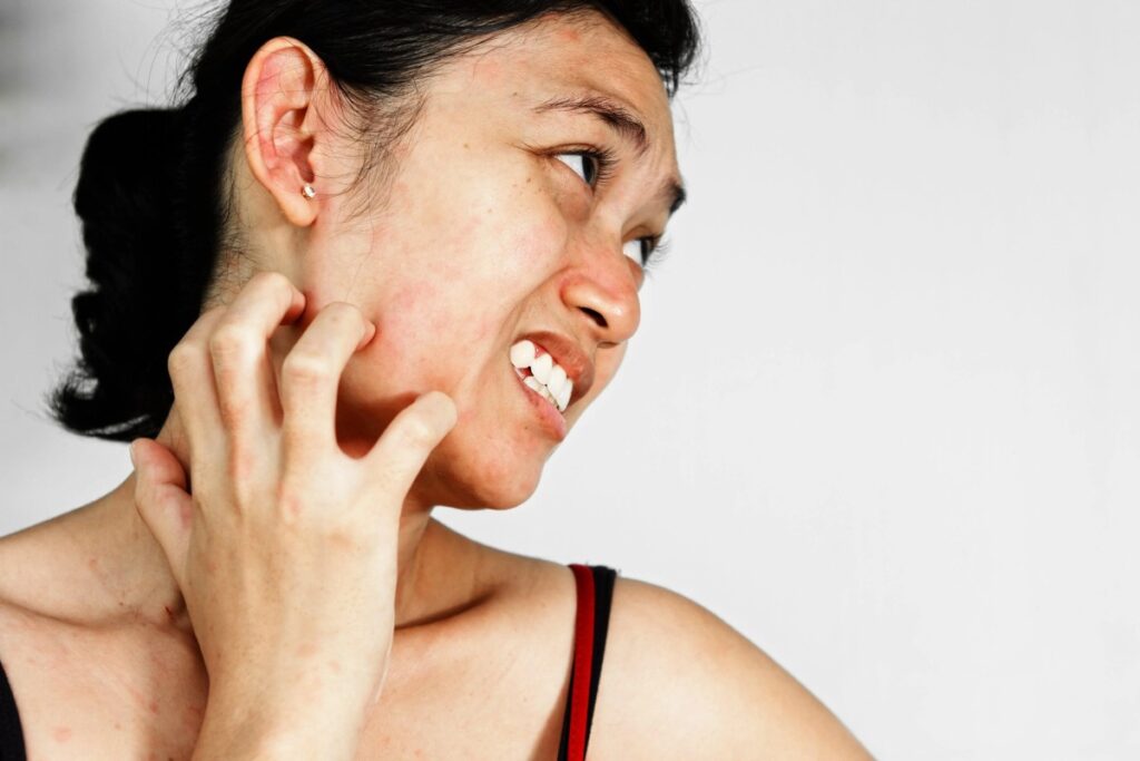 comment-calmer-démangeaison-se-gratter-astuce-experts.jpg